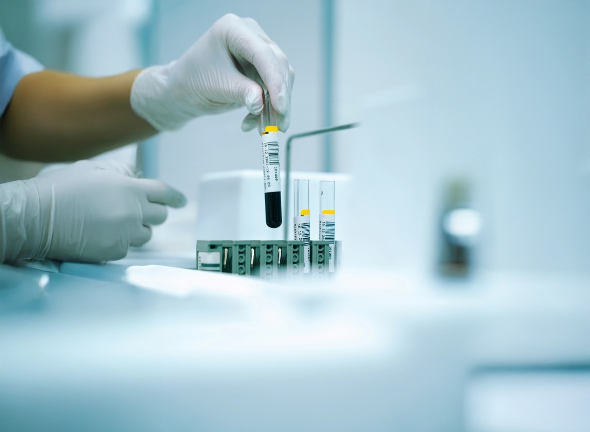 Allergia laborvizsgálat - Tudd meg, mi váltja ki a tüneteidet!